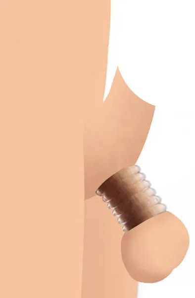 Master Series Ring Master Custom Ball Stretcher Kit Ball stretcher